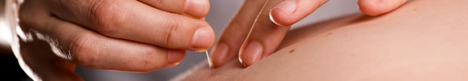 Hanna Evans Acupuncture