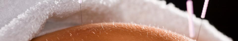 Hanna Evans Acupuncture