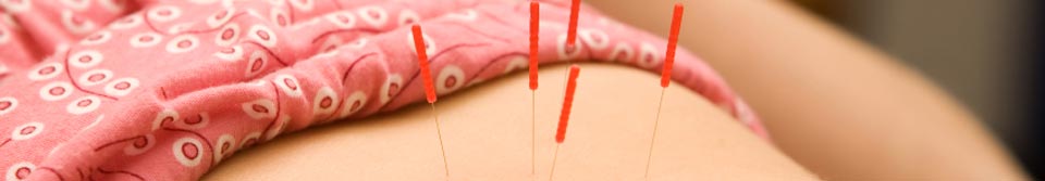 Hanna Evans Acupuncture